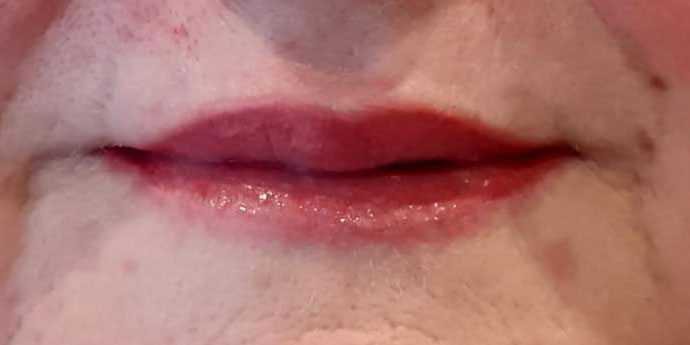 Sourire après dermopigmentation des lèvres